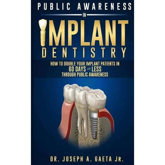 Public Awareness In Implant Dentistry: How To Double Your Implant Patients In 60 Days Or Less Through Public Awareness (Paperback)