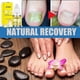 thumbnail image 2 of 3x 10ml Rapid Relief Oil, Onychomycosis Nail Treatment, Toenail Treatment Oil, 2 of 5