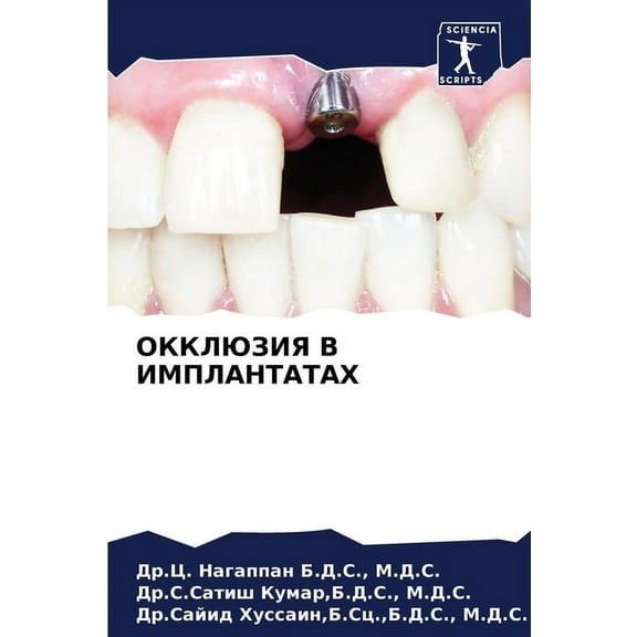 ОККЛЮЗИЯ В ИМПЛАНТАТАХ (Paperback)