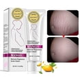 thumbnail image 1 of Crema para estrías y cicatrices de Mango, crema para eliminar estrías y cicatrices para el embarazo, la mejor crema hidratante corporal, 40g, 1 of 5