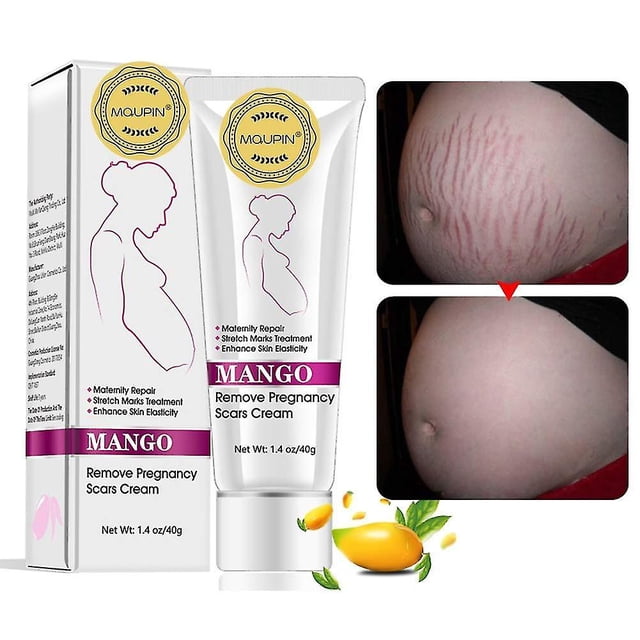 Crema para estrías y cicatrices de Mango, crema para eliminar estrías y cicatrices para el embarazo, la mejor crema hidratante corporal, 40g