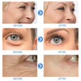 thumbnail image 2 of IBeaLee Retinol essence Solution Moisturizing, Firming and Shrinking Pore Vial essence, 2 of 5