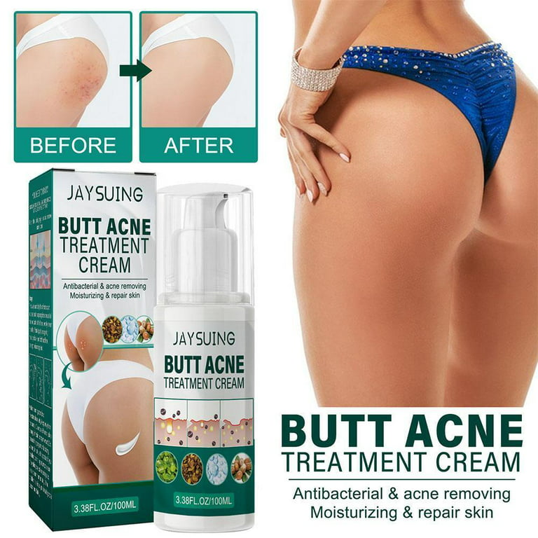 Seroflora Butt & Thighs Acne Treatment Cream - Butt Acne Clearing