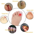 thumbnail image 2 of NOGIS Big Toe Caps 10 Pieces - Breathable Gel Toe Protector, Great to Cushion Toe and Provides Pain Relief from Corns, Blisters, Missing or Ingrown Toenails for Woman and Man (White), 2 of 6