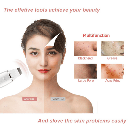 Ultrasonic Skin Spatula, Skin Scrubber Facial Cleaner,Blackhead Remover,Pore Cleaner, Comedones Extractor for Facial Deep Cleansing Peeling Lifting Facial Tools,3 Modes,USB Charger | Walmart Canada