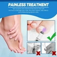 thumbnail image 6 of Non-Invasive Skin and Removal Pen Advanced Dark Corrector for Face Body Safe Gentle All Skin Types, 6 of 8