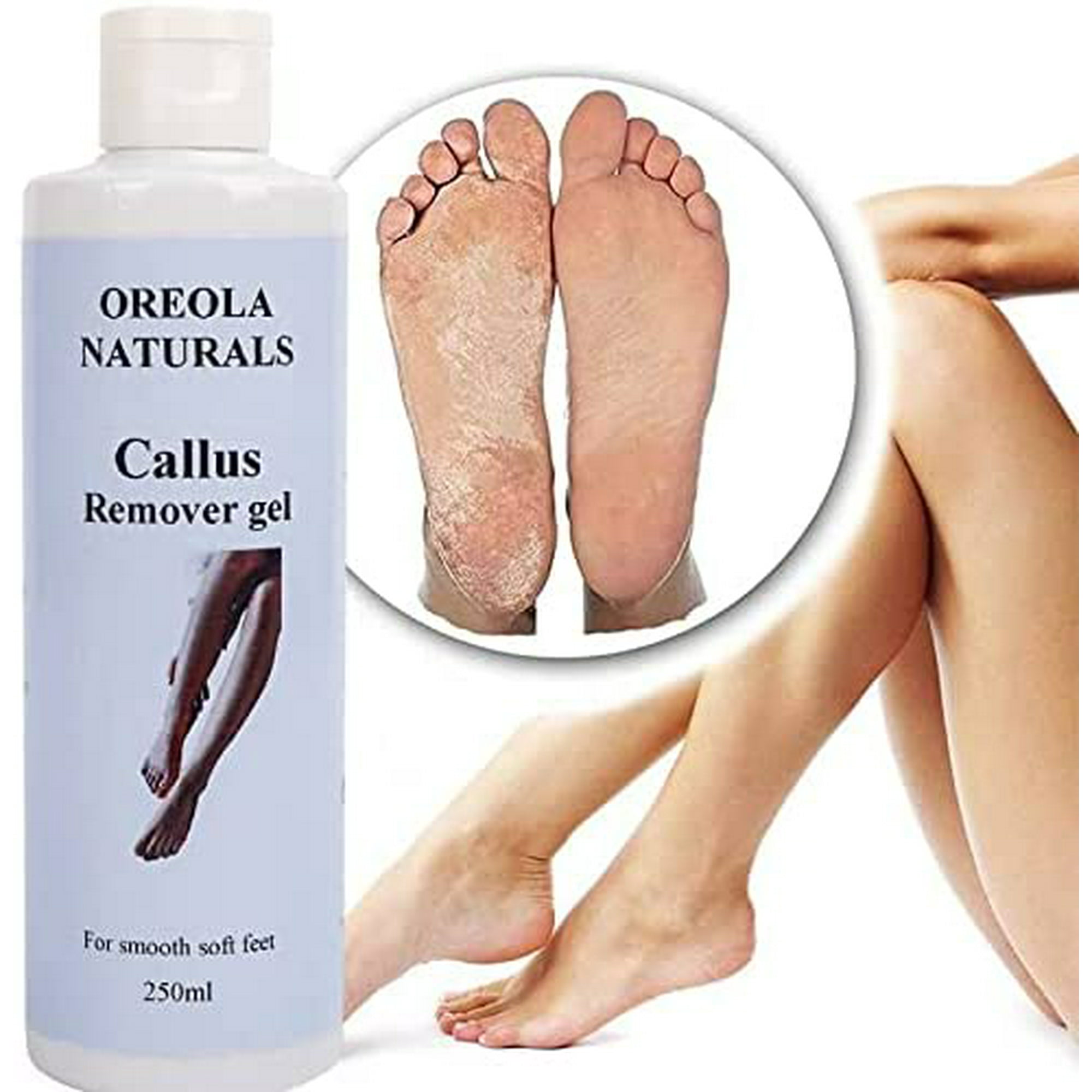 Callus Remover Gel Best Callus Remover Gel for Callus and Corn on the feet 250ml