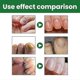 thumbnail image 4 of Onychomyx Nail Repair Nourishing Solution To Onyx Nails Bright Nails, 4 of 5
