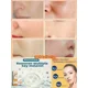 thumbnail image 4 of Suero eliminador de manchas oscuras, potente eliminación de puntos negros, Melasma, Chloasma, niacinamida, blanqueamiento, humedad, pecas, cuidado de la piel facial, 4 of 5