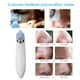 thumbnail image 4 of Ygjytge Eliminador De Puntos Negros Y Acné Facial, Máquina De Limpieza De Poros Con Succión Al Vacío (Blanco C) Ygjytge Para estrenar, 4 of 6