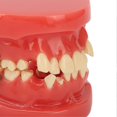 thumbnail image 3 of Dental Typodont Orthodontic Teeth Model Teaching Tool 24 Teeth Resin Dental Demonstration Study Model, 3 of 5