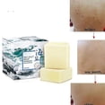 thumbnail image 1 of Nuevo limpiador de jabón de sal marina, eliminación de espinillas, poros, tratamiento de acné, jabón, leche de cabra Sm17616 LingWen 9024735454557, 1 of 5