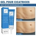 3 Pack Scar Gel Silicone Scar Gel For Scar Removal Moisturizing Scar Formula Silicone Gel