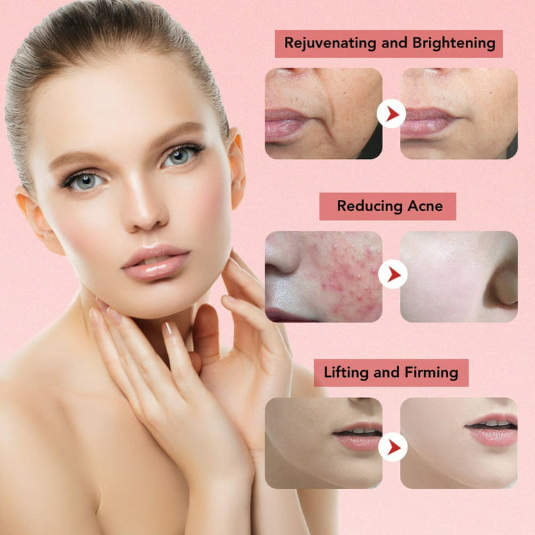 7 in 1 Face Lift Device - EMS RF Microcurrent Skin Rejuvenation