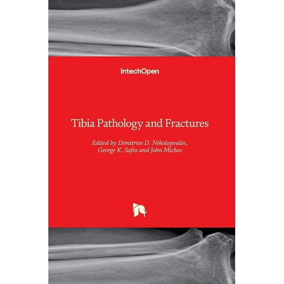 Tibia Pathology and Fractures (Hardcover)