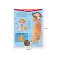 thumbnail image 2 of Póster Aparato Reproductor Masculino Educatodo B-0017-I, 2 of 2