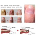 thumbnail image 2 of essential oil for nail fungus ginger 10ml, 2 of 5