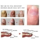 thumbnail image 2 of essential oil for nail fungus ginger 10ml, 2 of 5