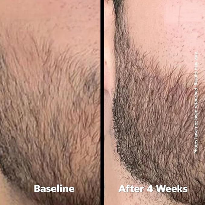 DABALASH Men Professional Beard and Mustache Strength Serum with Castor Oil – 0.18 oz