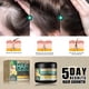 thumbnail image 3 of Crema mágica para el crecimiento del cabello (ayuda con la caída del cabello, calvicie, zonas calvas, adelgazamiento del cabello, caída del cabello. Engrosa el cabello)., 3 of 5