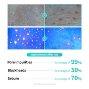 essl Centella Poreless Deep Cleansing Oil, 5.1 fl. oz.
