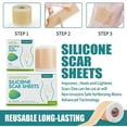 thumbnail image 2 of 150cm Silicone Gel Scar Sheet Patch Treatment Removal Tape Acne Trauma Burn Scar Cover Skin, 2 of 5