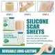 thumbnail image 2 of 150cm Silicone Gel Scar Sheet Patch Treatment Removal Tape Acne Trauma Burn Scar, 2 of 5