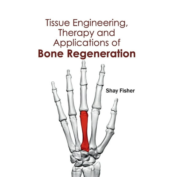 Tissue Engineering, Therapy and Applications of Bone Regeneration, (Hardcover)