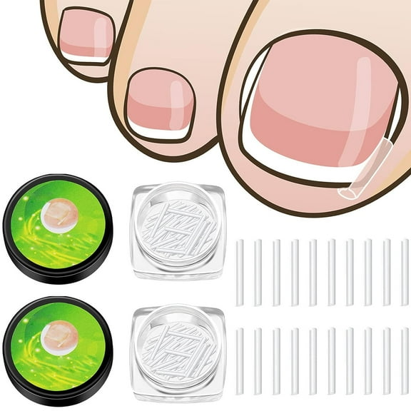 50/100 Pcs Ingrown Toenail Corrector Strips Toenail Correction Patches Curved Toenails Straightening Recover Clips For Men Women Foot Care - quantity:100 pieces;