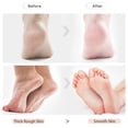 thumbnail image 4 of 2 Pcs Pierre Ponce Double pour Pieds, Outils de Pédicure Efficaces, 4 of 7