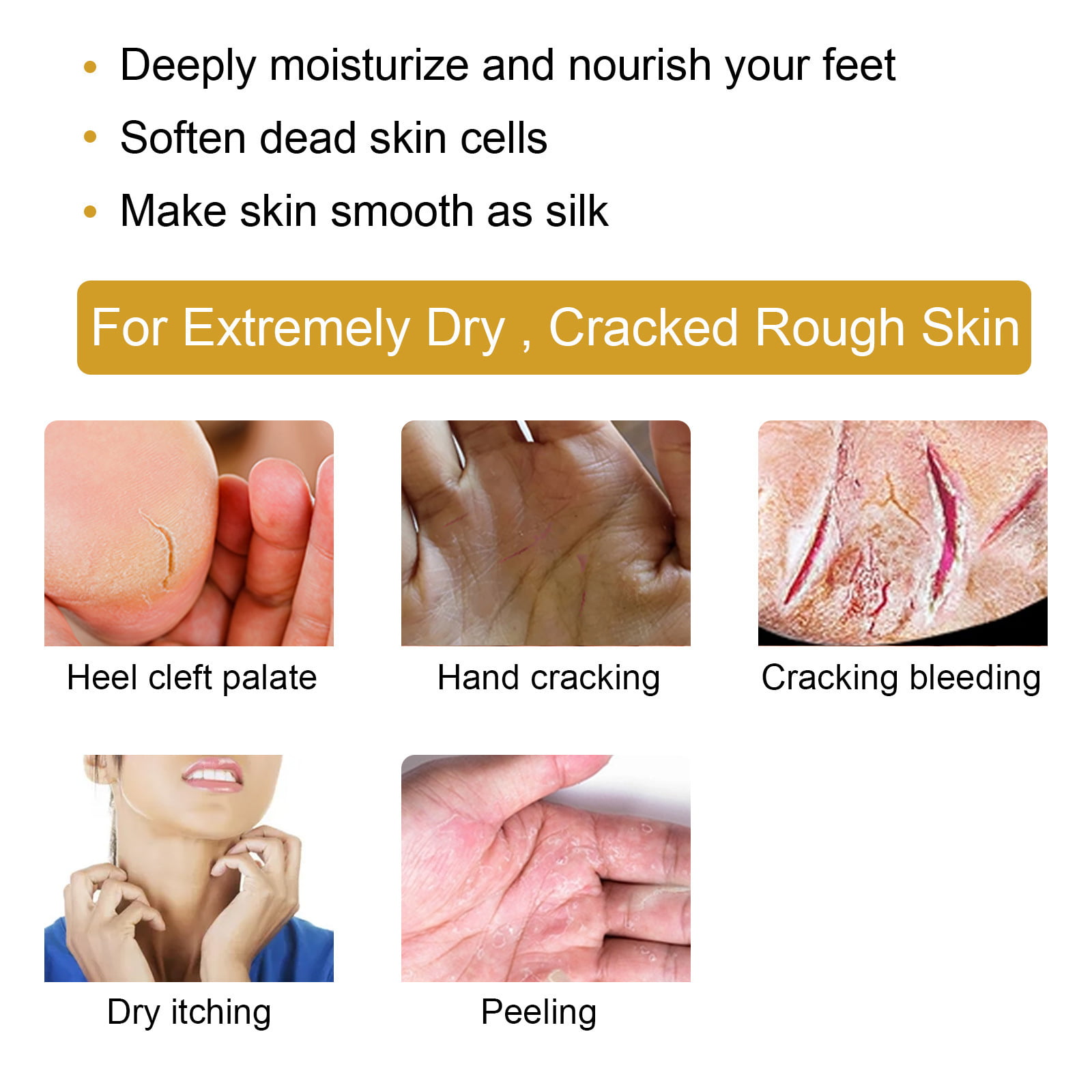 Smartdrops Chapped Hand And Foot Cream Crack Peeling Repair Anti Dry Skin Remove  Dead Skin Foot Moisturizing (50gm) (For Women and men) Pack of 4
