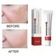 thumbnail image 4 of Crema Para Pecas, Crema Hidratante Reparadora Para Melasma, Manchas Oscuras, Hidratante Yuyangstore Cara Peca Nutritiva, 4 of 8
