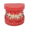 thumbnail image 2 of Modelo de Ortodoncia Soporte de Cerámica de Alambre de Metal ANGGREK 24 Dientes, 2 of 7