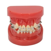 Ceramic dental orthodontic demonstration model 24 teeth model with wires and brackets for teaching and education