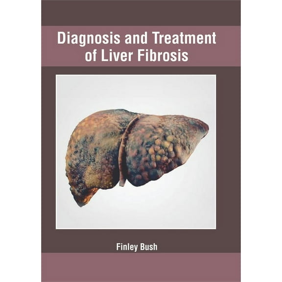 Diagnosis and Treatment of Liver Fibrosis, (Hardcover)