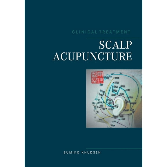 Scalp Acupuncture, (Paperback)
