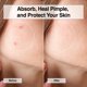 thumbnail image 4 of Pimple Patch FreeGo XOXO Hydrocolloid 120 unidades de ácido salicílico, 4 of 8
