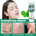 thumbnail image 4 of Limpiador facial limpiador facial Pines Soothing Centella Asiatica Cleanser Centella Cleanser Face Cleanser Gentle Cleanser Mousses Moisturizing Cleanser, Regalo para mujeres 100 ml (Compre 2 y ahorre, 4 of 9