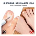 thumbnail image 3 of Toenail Cor, 3 of 3