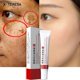thumbnail image 1 of Dimollaure-crema facial blanqueadora para pecas, elimina el Melasma, manchas oscuras, pigmento de melanina, hidratante, ilumina, crema de día, cuidado de la piel"3pcs" Fivean LED, 1 of 2