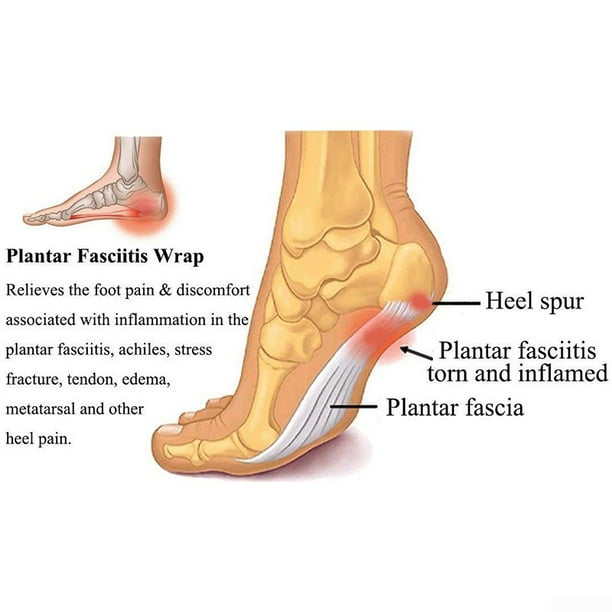 Foot arch shop support for yoga