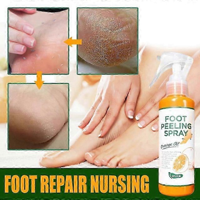 spray para eliminar callos de los pies, exfoliante, antisecado, para reparar talones agrietados, pedicura, para manos y codos, elimina piel muerta, líquido para pies, 100 ml — botella spray de 100 ml con etiqueta 'Foot Peeling Spray' y dibujo de naranja; montaje con primer plano de talón seco y descamado, manos aplicando el producto y talón con piel visiblemente más lisa; fondo claro tipo anuncio; también apto como tratamiento exfoliante puntual para codos secos.
