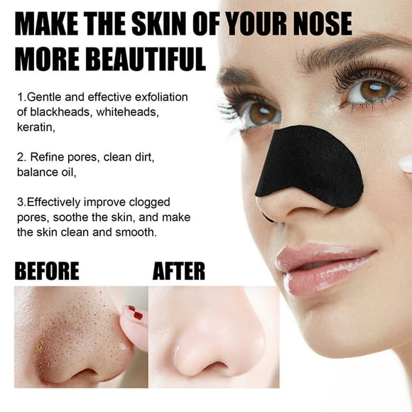 10 Pcs Blackhead Nose Patch Nose Pore Cleansing Strips Deep Cleansing Blackhead Remover Strips for Women Men