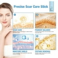 thumbnail image 5 of Silicone Scar Stick, 80% Silicone Stick for Face and Body. Silicone Stick for Removal of Surgical,Old and Recent Scars and Stretch Marks - 7g, 5 of 10