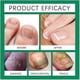 thumbnail image 4 of 3x Nail Shield Anti-fungal Stick Nailshield Anti Fungal Stick,monsalife Nail Shield Anti Fungal Stick, 4 of 5