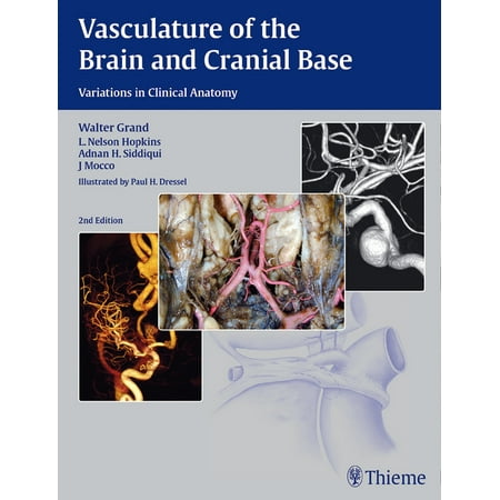 UPC: 9781604068856 | Vasculature of the Brain and Cranial Base (Hardcover)