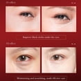 thumbnail image 4 of Pomegranate Eye Mask Patch Improves Dark Circles Wrinkles And Eye Bags 80ml, 4 of 9