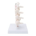 thumbnail image 1 of Human Osteoporosis Modelsafe, Eco-friendly Durable Osteoporosis Model Firm  For Teaching For Model Display For Doctor-patient Explanation, 1 of 8