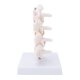 thumbnail image 3 of Modelo profesional de osteoporosis, modelo anatómico de columna vertebral humana para demostración didáctica., 3 of 14