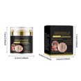 thumbnail image 3 of Hot6sl Ofertas de La Semana Crema Blanqueadora Contra Manchas Blancas Crema Blanqueadora Antipecas Corrector Hidratante para Manchas Oscuras En La Cara, 3 of 7